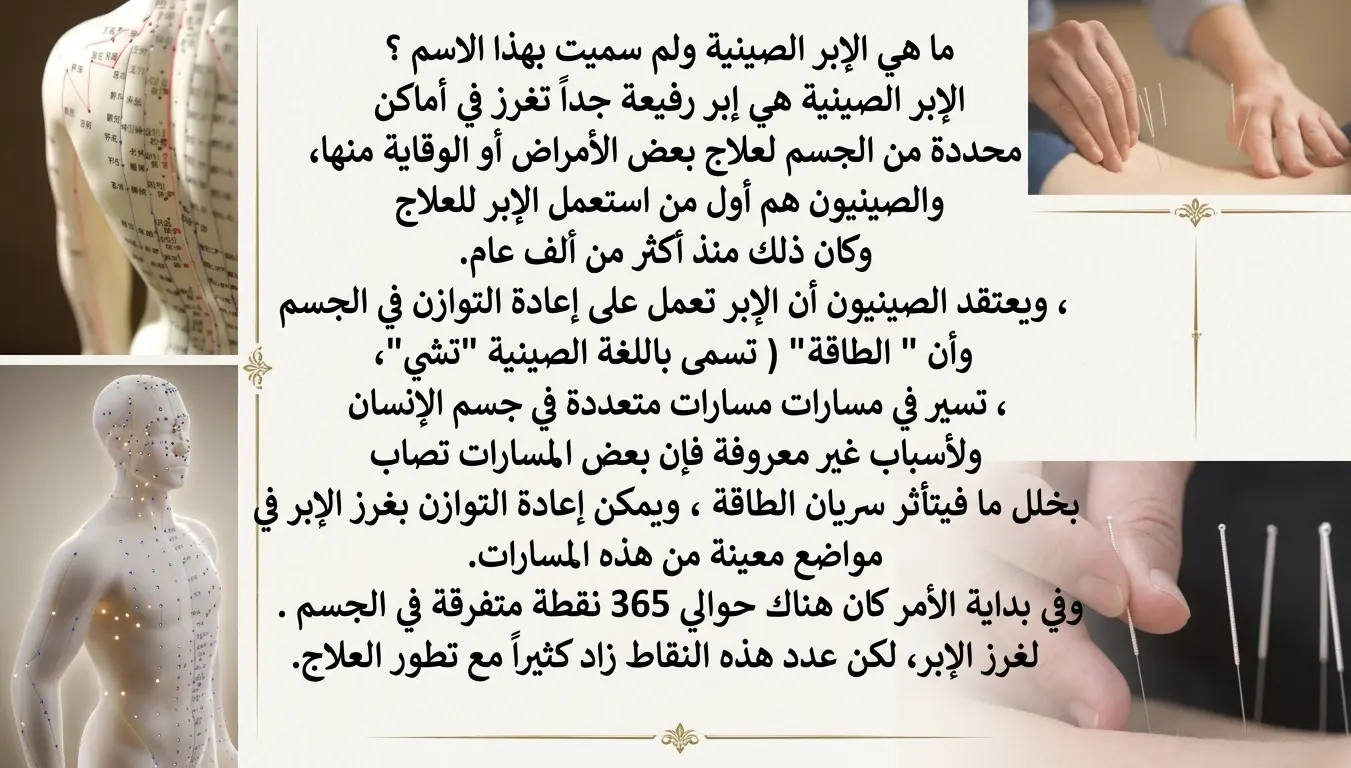 البطاقة الحادية والثلاثون - الإبر الصينية